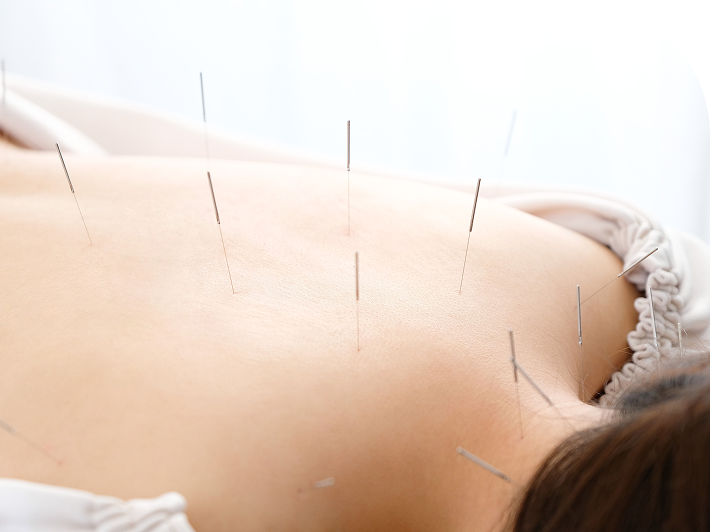 施術を受けている様子