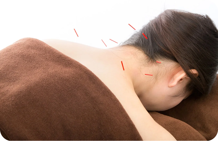 施術を受けている様子